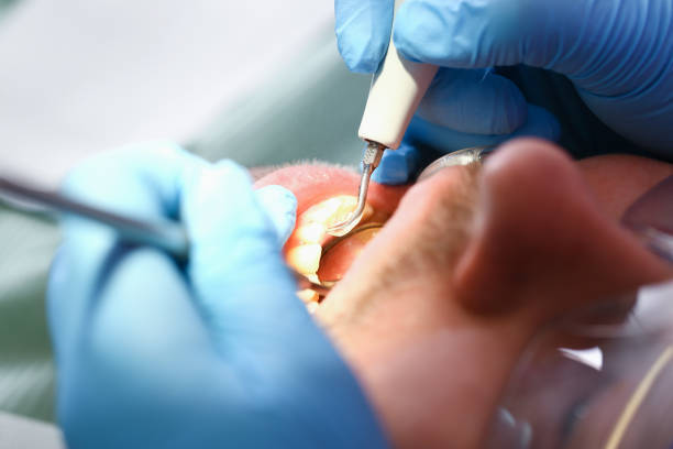 Best Emergency Care for Gum Disease in Roland, AR